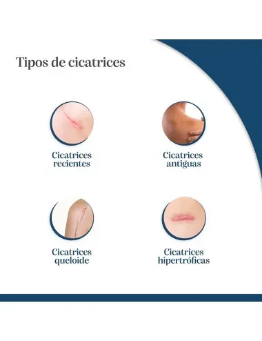 Trofolastin Reductor de...