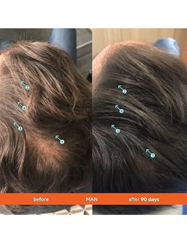DS Labs Revita Hair Density...