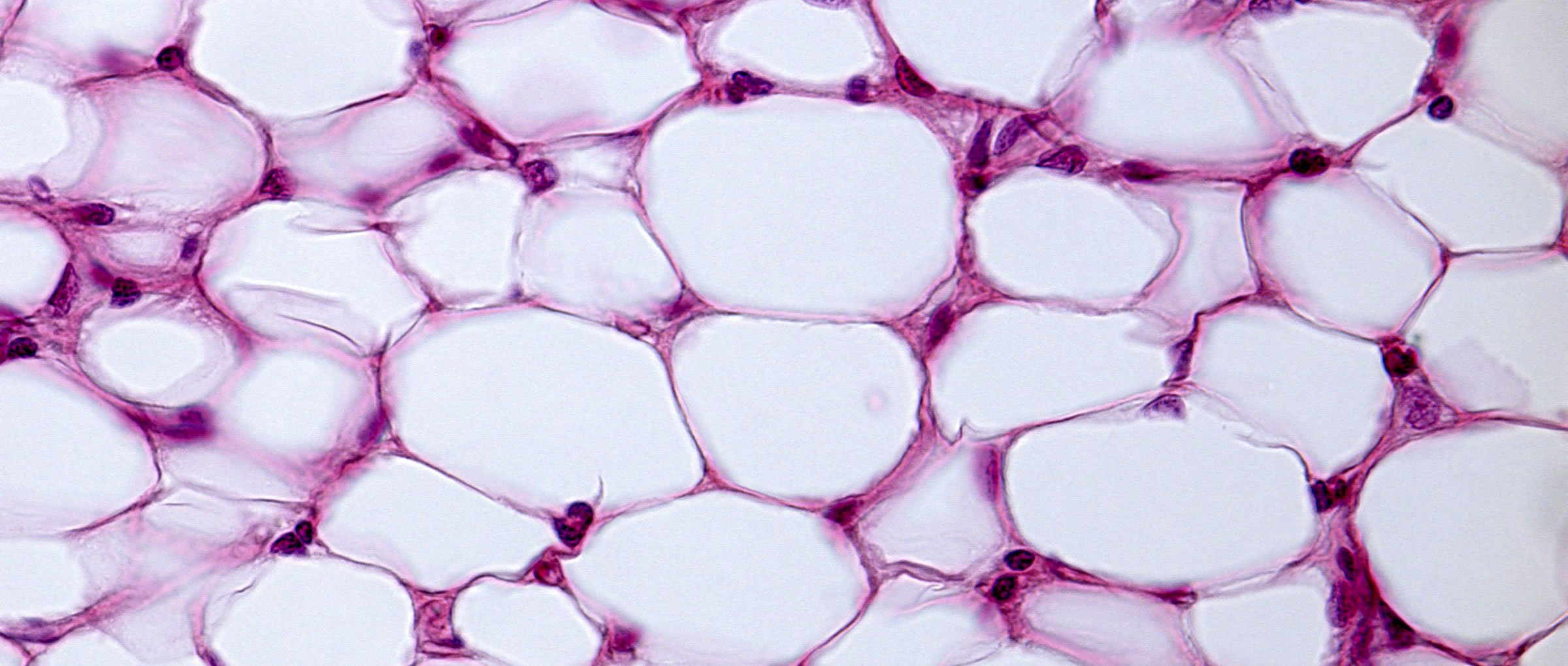 Adipocitos formando tejido adiposo